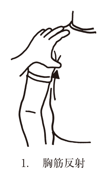 選択肢1