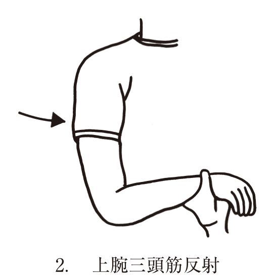選択肢2
