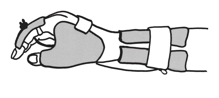選択肢3