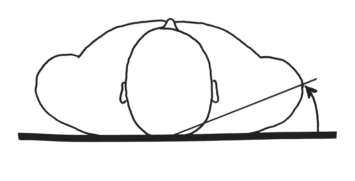 選択肢3