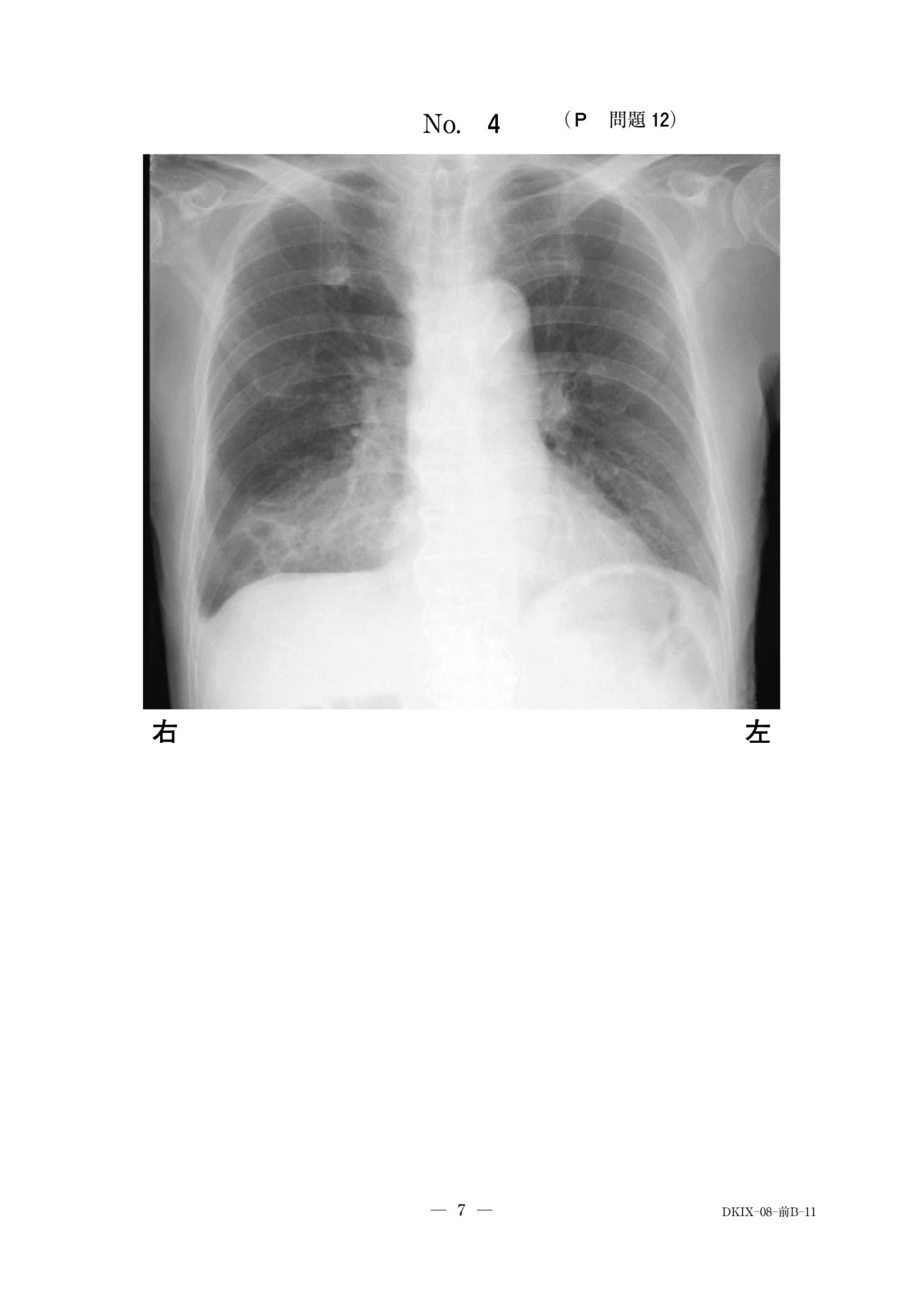 この問題の図(公式別冊)