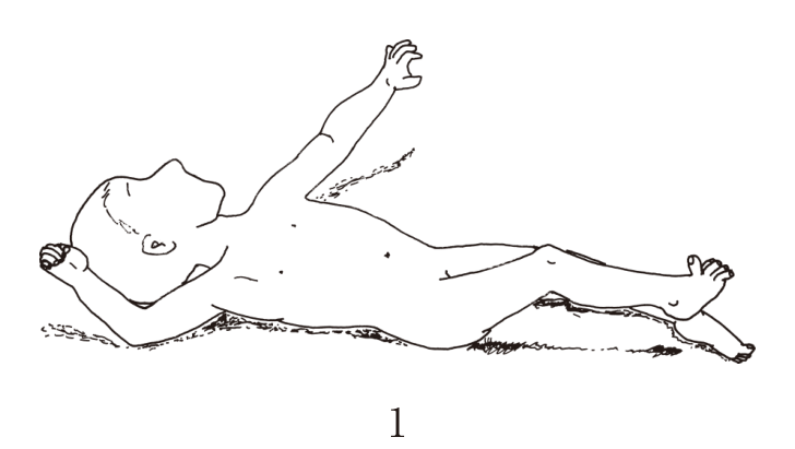 選択肢1