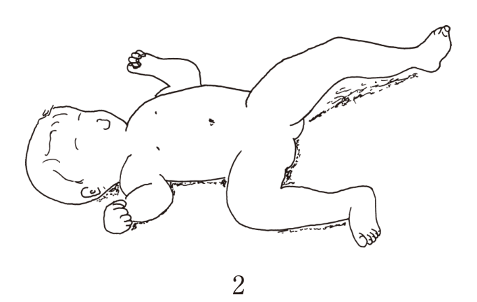 選択肢2