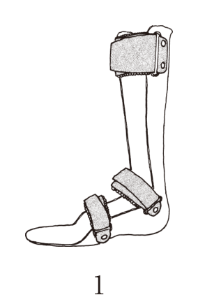 選択肢1