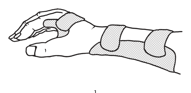 選択肢1