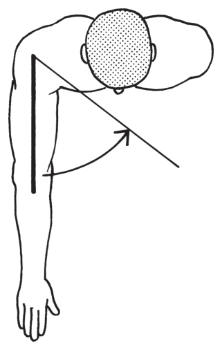 選択肢1