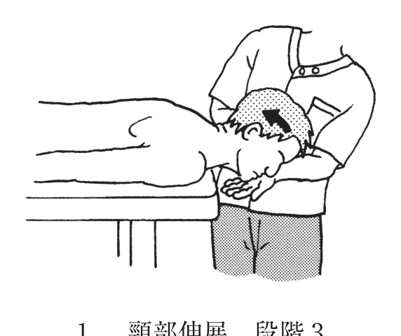選択肢1