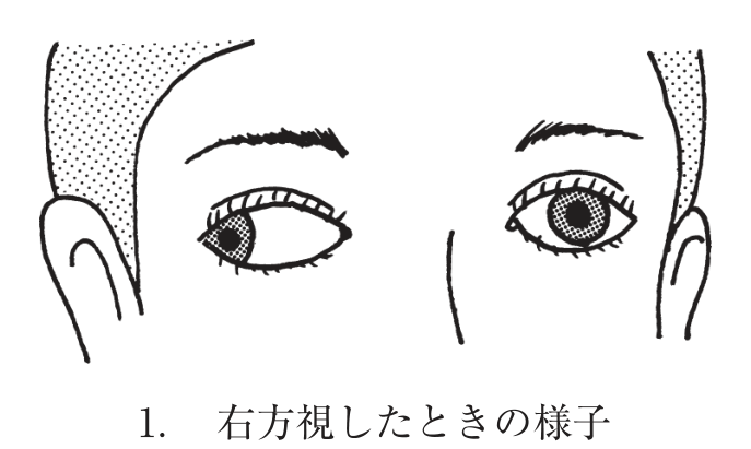 選択肢1