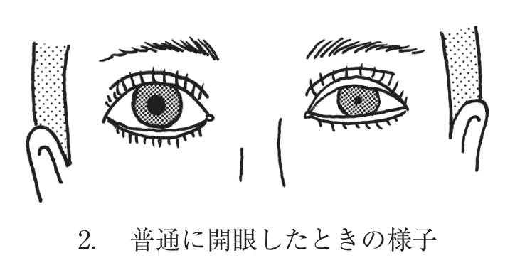 選択肢2
