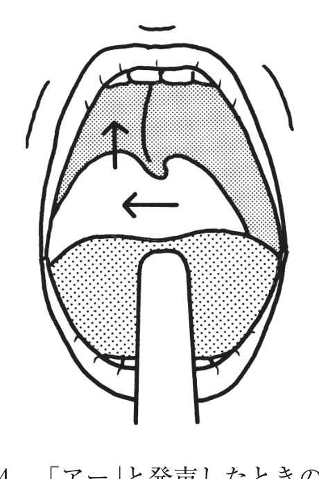 選択肢4
