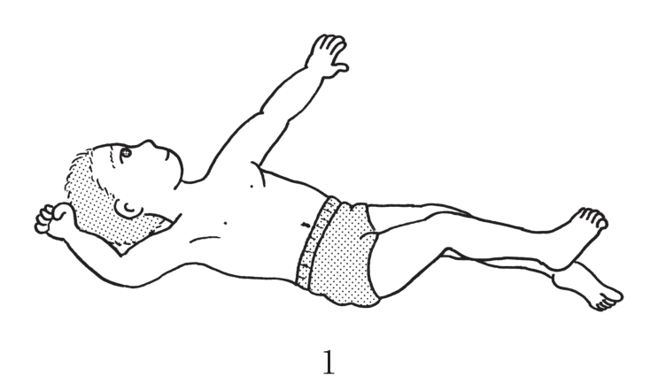 選択肢1