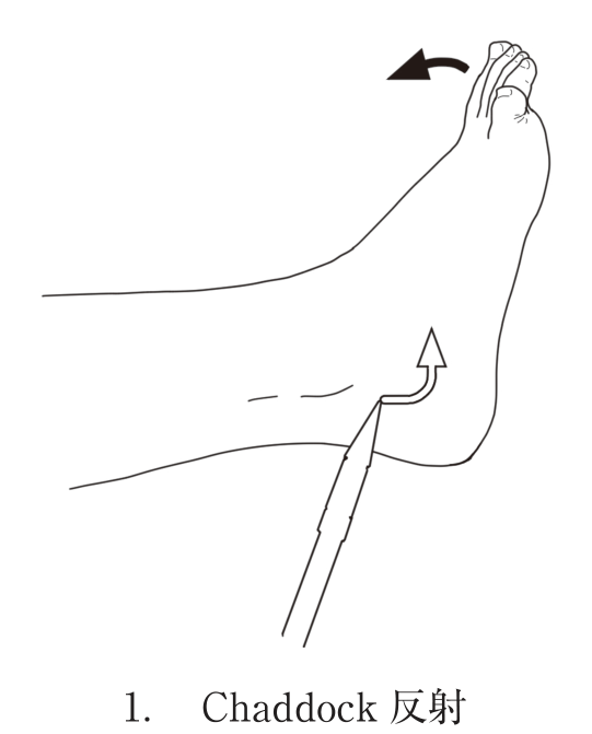 選択肢1