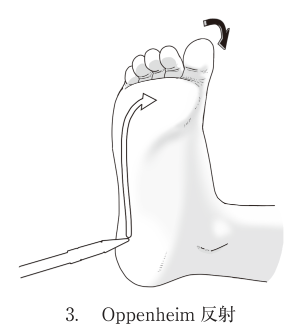 選択肢3